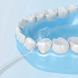 Набор для чистки зубов и полости рта Mijia T500 + ME0701 DDYST01SKS фото 2