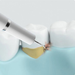 Скалер ультразвуковой для чистки зубов DR.BEI YC2 фото 1